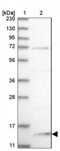 Anti-SNU13 antibody produced in rabbit 