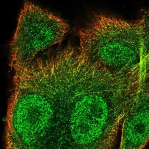Anti-SNX10 antibody produced in rabbit 