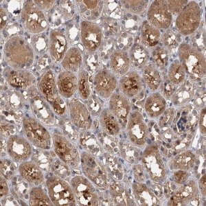 Anti-SNX15 antibody produced in rabbit 