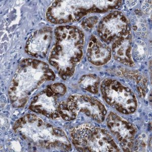 Anti-SNX19 antibody produced in rabbit 