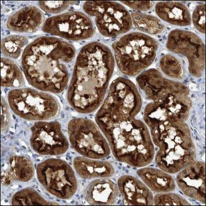 Anti-SNX3 antibody produced in rabbit HPA028638-100UL