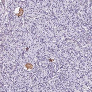 Anti-SNX31 antibody produced in rabbit 
