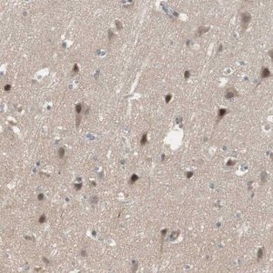 Anti-SNX4 antibody produced in rabbit 