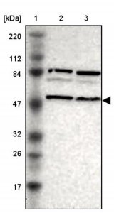 Anti-SNX4 antibody produced in rabbit 