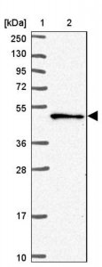 Anti-SNX5 antibody produced in rabbit 