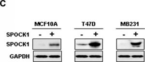 Anti-SPOCK1 antibody produced in rabbit 