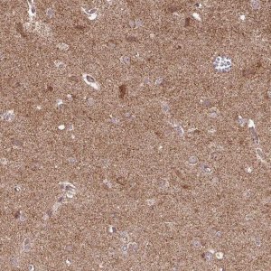 Anti-SPRED2 antibody produced in rabbit 