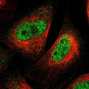 Anti-SPRTN antibody produced in rabbit 