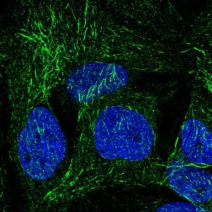 Anti-SPRY2 antibody produced in rabbit 