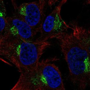 Anti-SPRY4 antibody produced in rabbit 