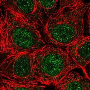 Anti-SPRYD4 antibody produced in rabbit HPA053469-100UL