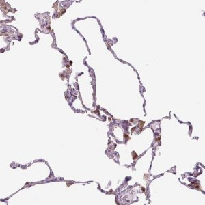 Anti-SPSB2 antibody produced in rabbit 
