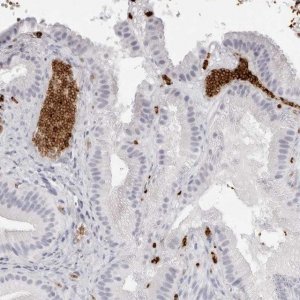 Anti-SPTA1 antibody produced in rabbit 