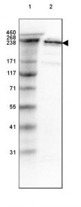 Anti-SPTBN1 antibody produced in rabbit 