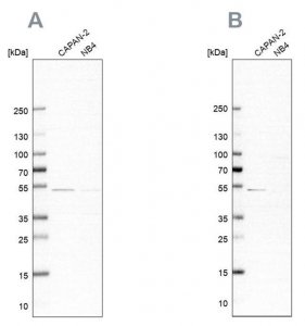 Anti-SPTLC1 antibody produced in rabbit 