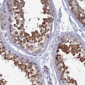 Anti-SRA1 antibody produced in rabbit 