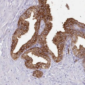 Anti-SRD5A1 antibody produced in rabbit 