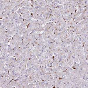Anti-SRD5A1 antibody produced in rabbit 