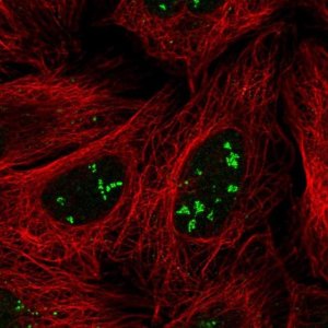 Anti-SRFBP1 antibody produced in rabbit 