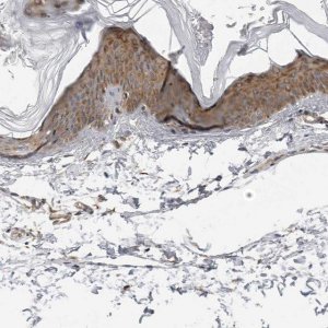 Anti-SRGAP2 antibody produced in rabbit 