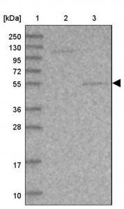 Anti-SRPX2 antibody produced in rabbit HPA038786-100UL