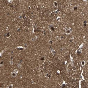 Anti-SRRM3 antibody produced in rabbit 