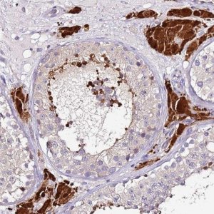 Anti-SRRM5 antibody produced in rabbit 