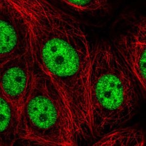 Anti-SRRT antibody produced in rabbit HPA058379-100UL