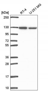 Anti-SRRT antibody produced in rabbit HPA058379-100UL