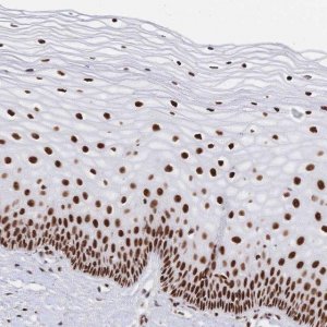 Anti-SRSF1 antibody produced in rabbit 