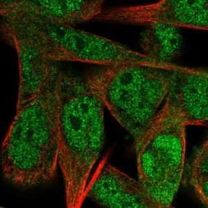 Anti-SS18L1 antibody produced in rabbit 