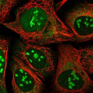 Anti-SS18L2 antibody produced in rabbit 