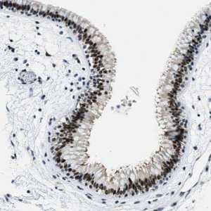Anti-SSB antibody produced in rabbit 