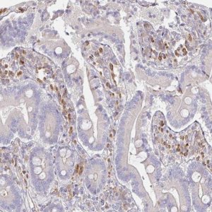 Anti-SSH2 antibody produced in rabbit 