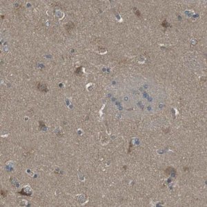 Anti-SSR3 antibody produced in rabbit 