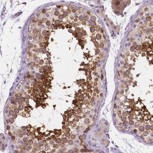 Anti-SSSCA1 antibody produced in rabbit 