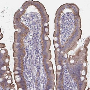 Anti-SSTR1 antibody produced in rabbit 
