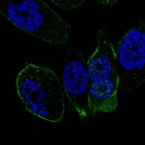 Anti-SSTR5 antibody produced in rabbit 