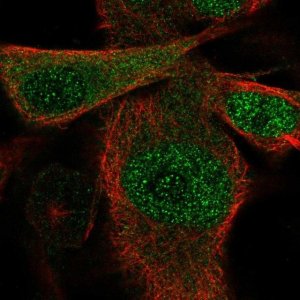 Anti-SSU72 antibody produced in rabbit 