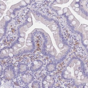 Anti-SSUH2 antibody produced in rabbit 