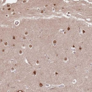 Anti-ST18 antibody produced in rabbit 