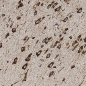 Anti-ST3GAL2 antibody produced in rabbit 