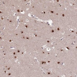 Anti-ST5 antibody produced in rabbit 