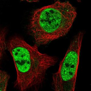 Anti-ST5 antibody produced in rabbit 