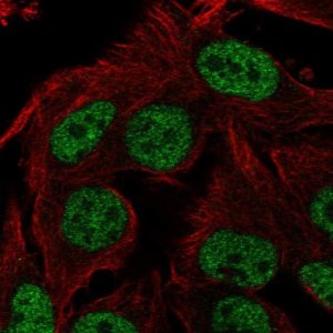 Anti-ST6GALNAC3 antibody produced in rabbit 
