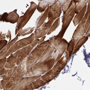 Anti-ST6GALNAC3 antibody produced in rabbit HPA055399-100UL