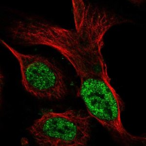 Anti-ST6GALNAC3 antibody produced in rabbit HPA055399-100UL