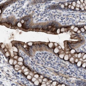 Anti-ST6GALNAC6 antibody produced in rabbit 