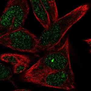 Anti-ST6GALNAC6 antibody produced in rabbit 