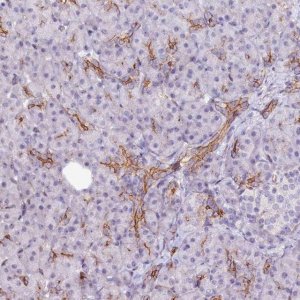 Anti-ST7 antibody produced in rabbit 